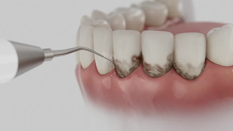 Reliable Tooth Extraction contractor in Wichita County County, TX by Dentist Open Now